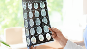 Arzt hält ein MRT Bild vom Gehirn gegen das Licht