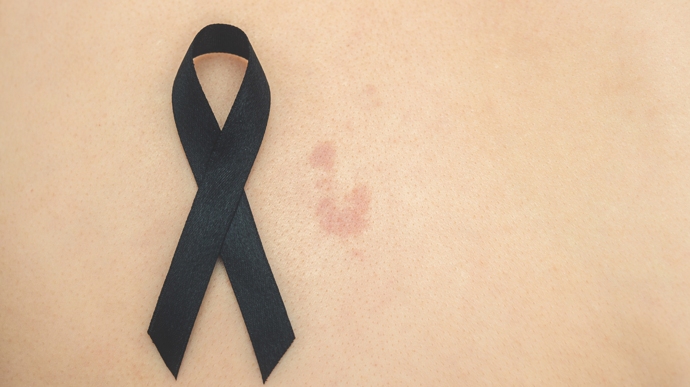 Haut und daneben die schwarze Krebsschleife